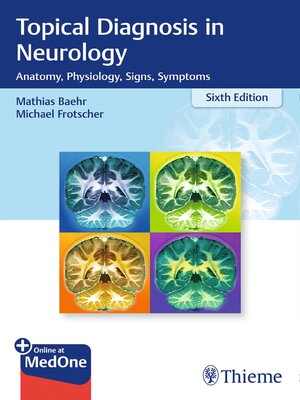 cover image of Topical Diagnosis in Neurology